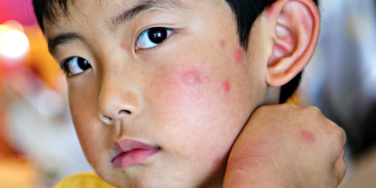 What Caused Your Child’s Allergic Skin Reaction? Environmental